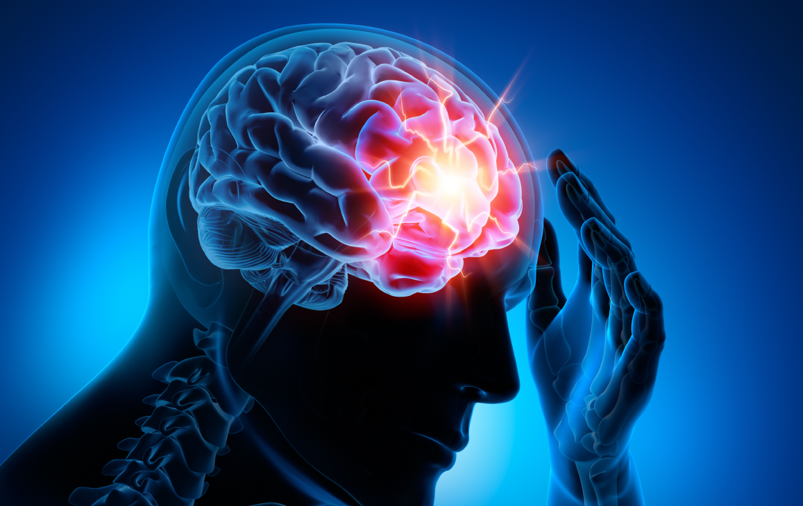 Headache, Migraine & Facial Pain